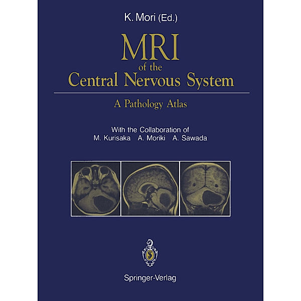 MRI of the Central Nervous System