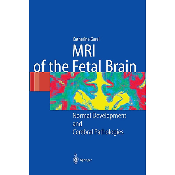 MRI of the Fetal Brain, C. Garel