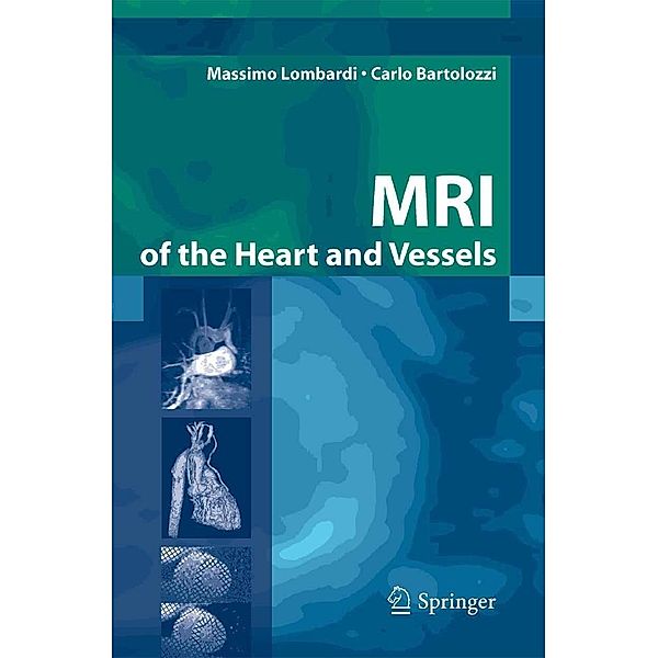 MRI of the Heart and Vessels, Massimo Lombardi, Carlo Bartolozzi