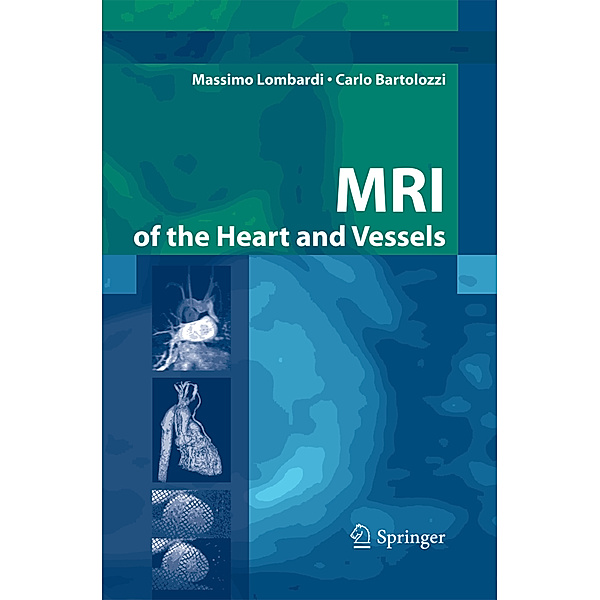 MRI of the Heart and Vessels, Massimo Lombardi, Carlo Bartolozzi