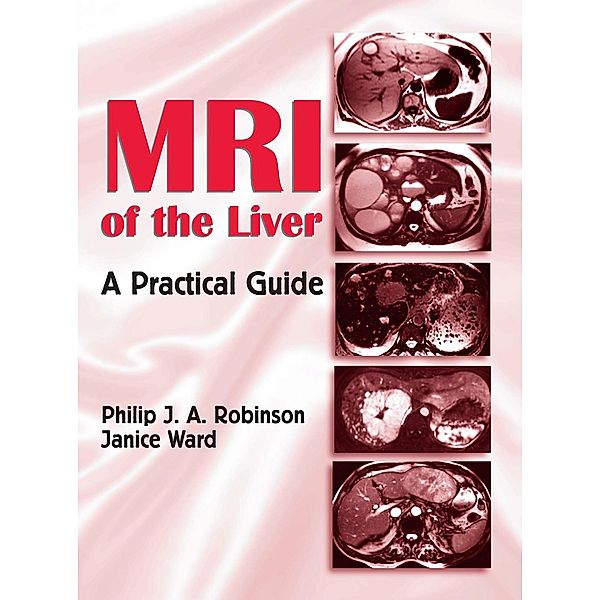 MRI of the Liver, Philip J. A. Robinson, Janice Ward