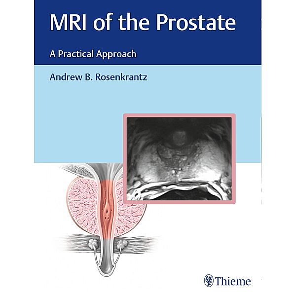 MRI of the Prostate