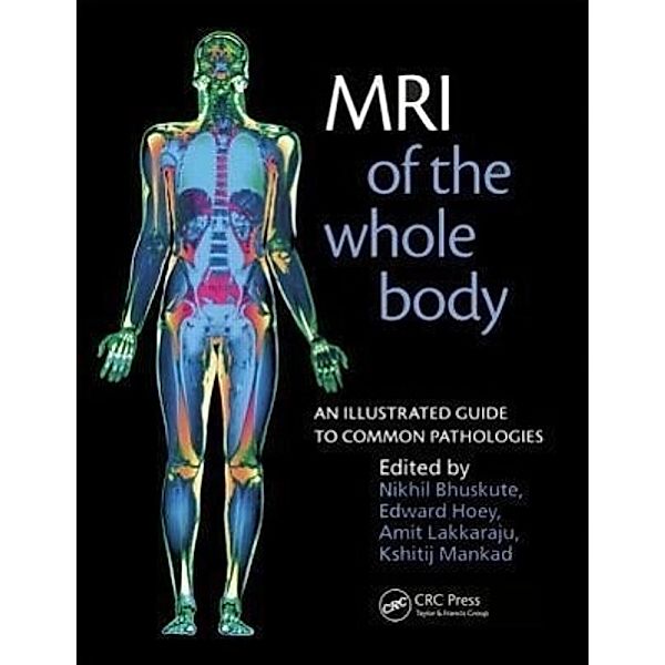 MRI of the Whole Body, Nikhil Bhuskute, Amit (Consultant Musculoskeletal Radiologist, Goulburn Valley Base Hospital, Shepparton, Australia) Lakkaraju, Kshitij Mankad