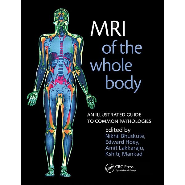 MRI of the Whole Body, Nikhil Bhuskute, Edward Hoey, Amit Lakkaraju, Kshitij Mankad