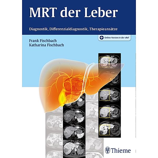 MRT der Leber