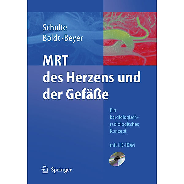 MRT des Herzens und der Gefäße, m. CD-ROM, B. Schulte, A. Boldt, D. Beyer
