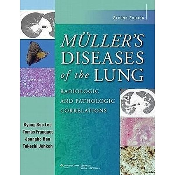 Muller's Diseases of the Lung, Kyung Soo Lee