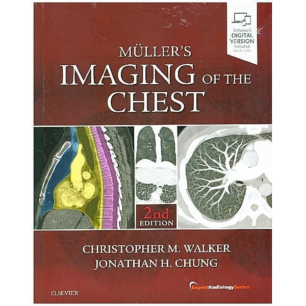 Muller's Imaging of the Chest, Christopher M. Walker, Jonathan H. Chung