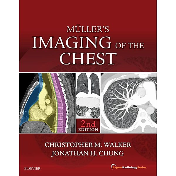 Muller's Imaging of the Chest E-Book / Expert Radiology Series, Christopher M. Walker, Jonathan H. Chung