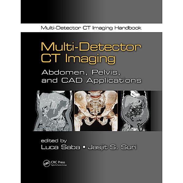 Multi-Detector CT Imaging