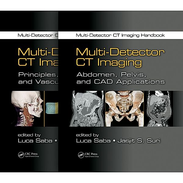 Multi-Detector CT Imaging Handbook, Two Volume Set