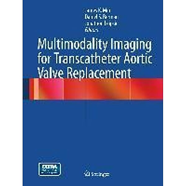 Multimodality Imaging for Transcatheter Aortic Valve Replacement