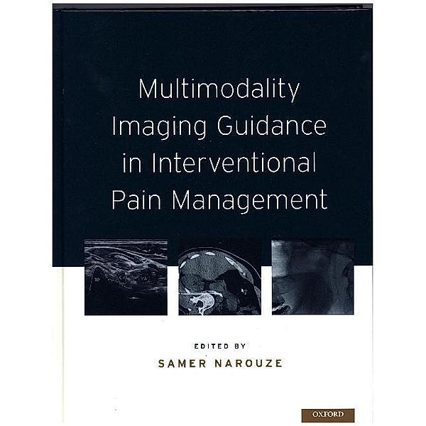 Multimodality Imaging Guidance in Interventional Pain Management