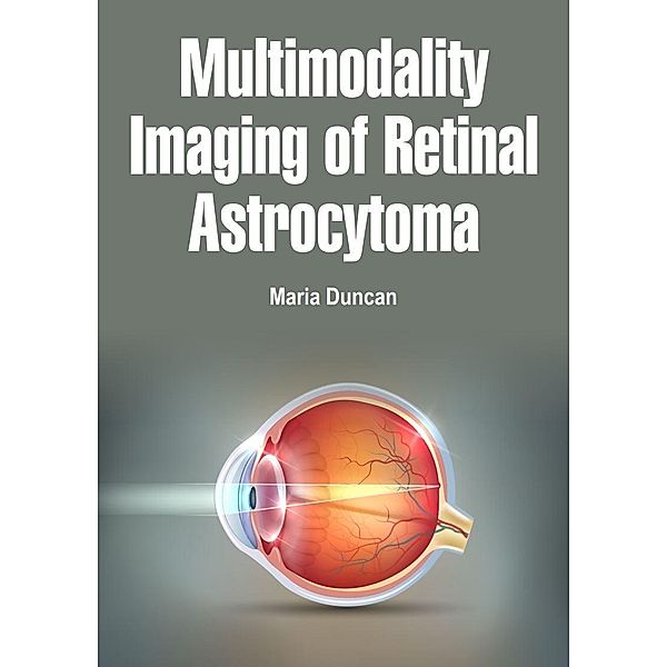 Multimodality Imaging of Retinal Astrocytoma, Maria Duncan