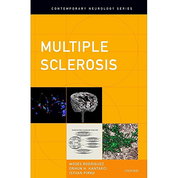 Multiple Sclerosis, Moses Rodriguez, Orhun H. Kantarci, Istvan Pirko