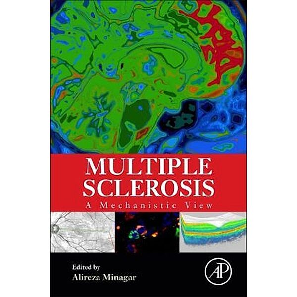 Multiple Sclerosis