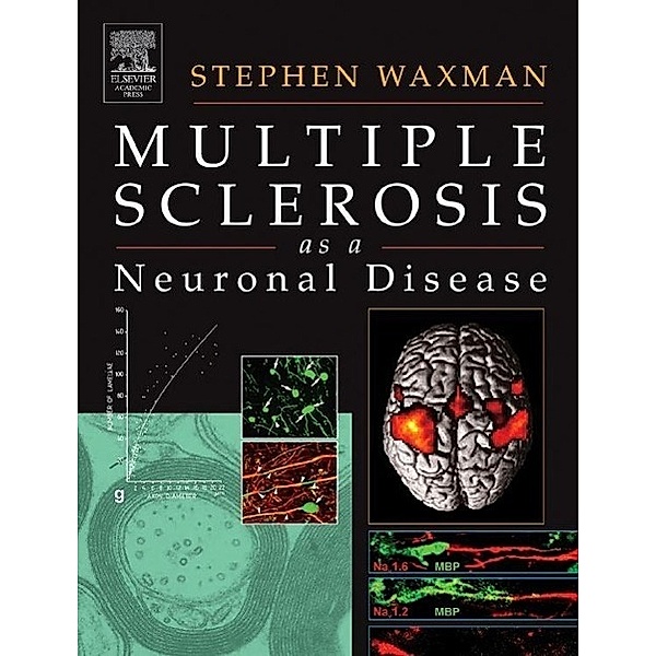 Multiple Sclerosis as a Neuronal Disease, Stephen Waxman