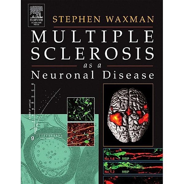 Multiple Sclerosis As A Neuronal Disease, Stephen Waxman