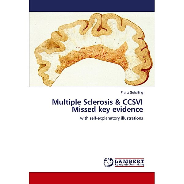 Multiple Sclerosis & CCSVI Missed key evidence, Franz Schelling