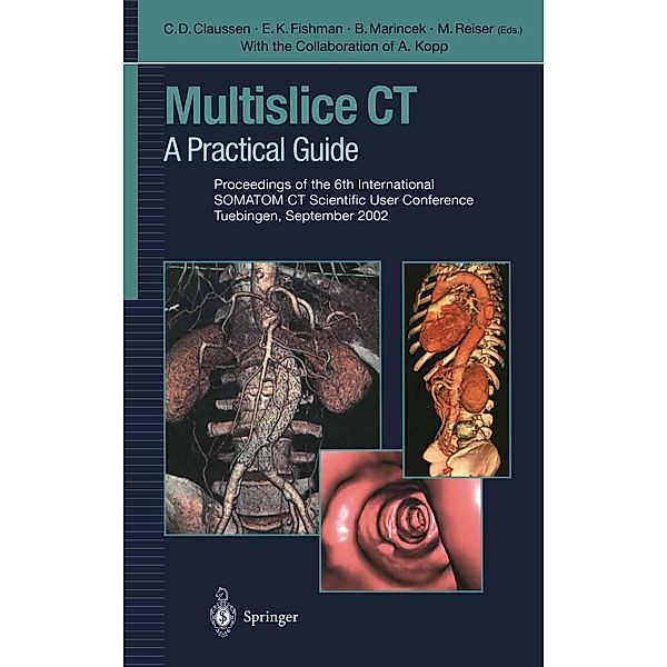 Multislice CT