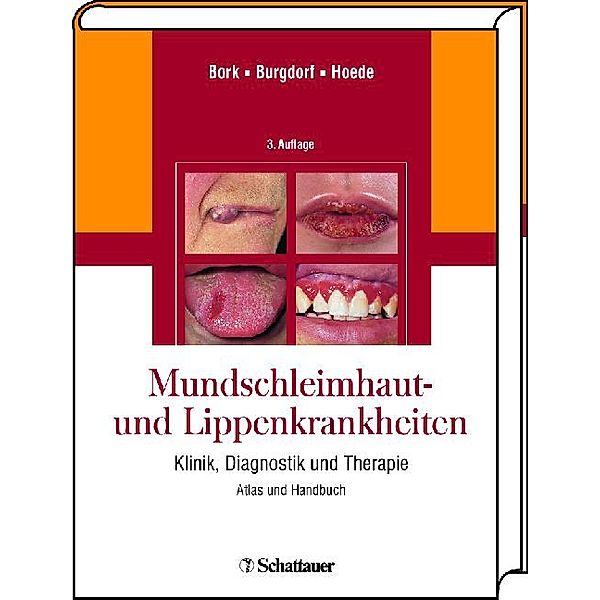 Mundschleimhaut und Lippenkrankheiten, Konrad Bork, Walter Burgdorf, Nikolaus Hoede