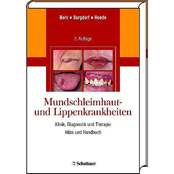 Mundschleimhaut- und Lippenkrankheiten, Konrad Bork, Walter Burgdorf, Nikolaus Hoede
