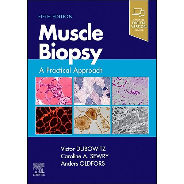 Muscle Biopsy E-Book, Victor Dubowitz, Caroline A. Sewry, Anders Oldfors