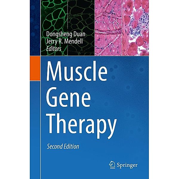 Muscle Gene Therapy