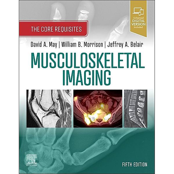 Musculoskeletal Imaging, David A. May, William Brian Morrison, Jeffrey A. Belair