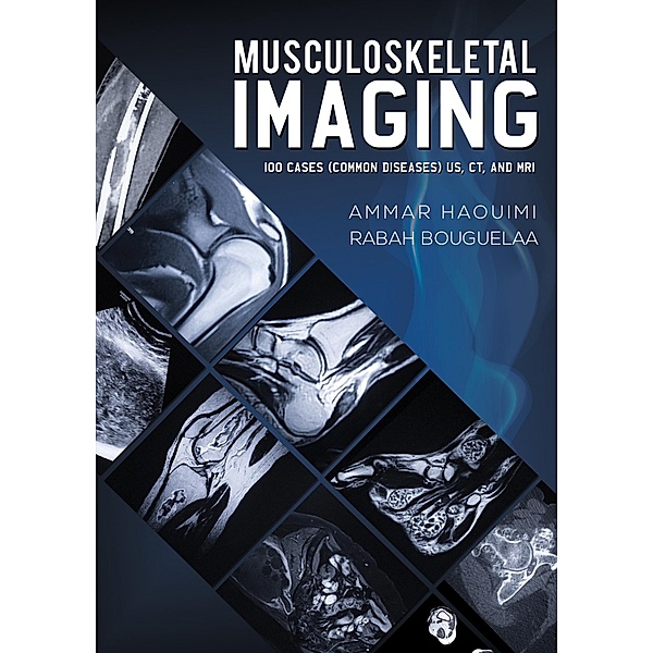 Musculoskeletal Imaging / Austin Macauley Publishers, Ammar Haouimi