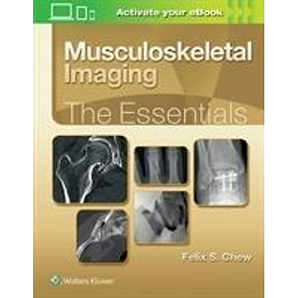 Musculoskeletal Imaging: The Essentials, Felix S. Chew