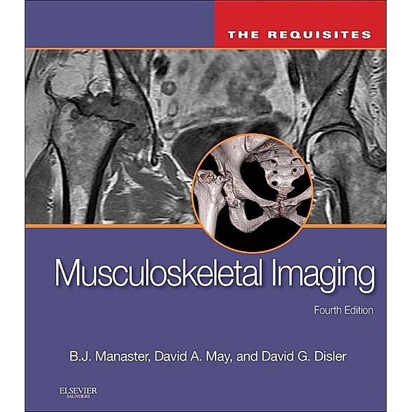 Musculoskeletal Imaging: The Requisites E-Book, B. J. Manaster, David A. May, David G. Disler