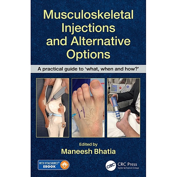 Musculoskeletal Injections and Alternative Options