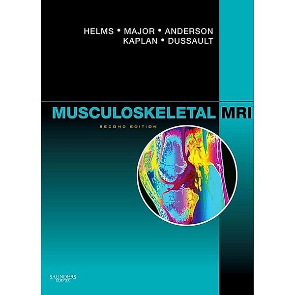 Musculoskeletal MRI E-Book, Mark W. Anderson, Robert Dussault, Clyde A. Helms, Nancy M. Major, Phoebe Kaplan