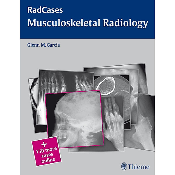 Musculoskeletal Radiology, Glenn M. Garcia