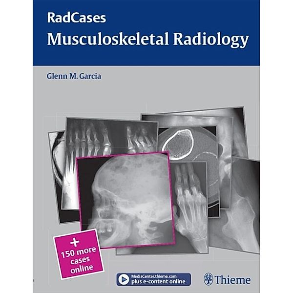 Musculoskeletal Radiology / Thieme