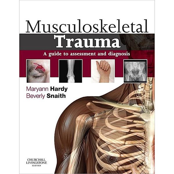 Musculoskeletal Trauma E-Book, Maryann Hardy, Beverly Snaith