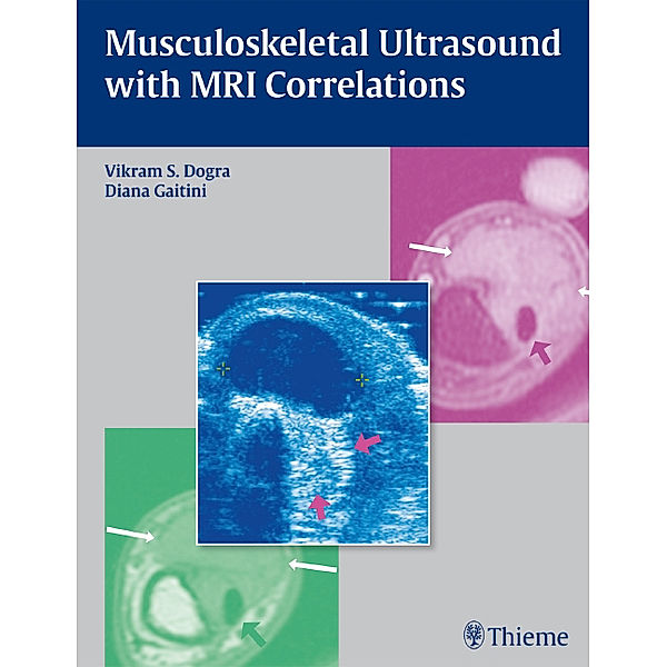 Musculoskeletal Ultrasound with MRI Correlations, Vikram S. Dogra, Diana Gaitini
