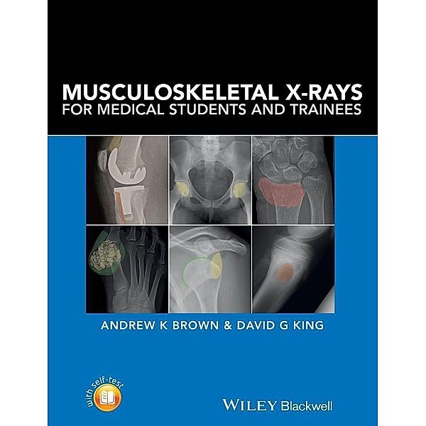 Musculoskeletal X-Rays for Medical Students and Trainees, Andrew K. Brown, David G. King