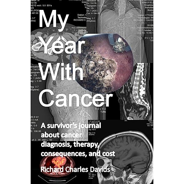 My Year with Cancer, Richard Charles Davids