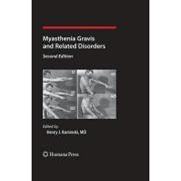 Myasthenia Gravis and Related Disorders / Current Clinical Neurology