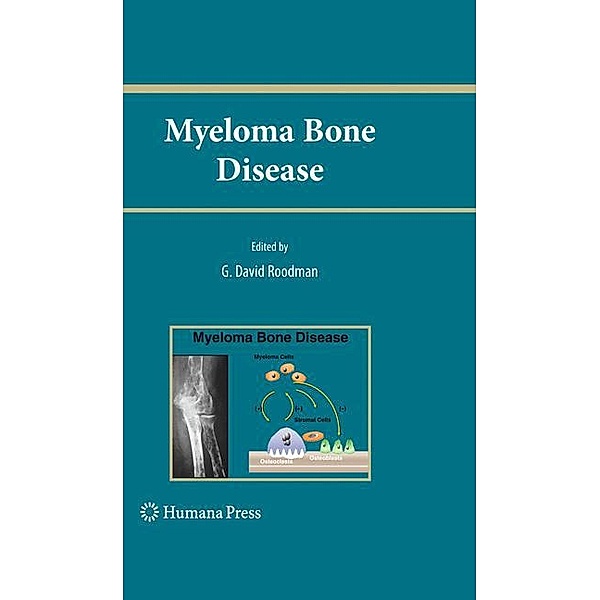 Myeloma Bone Disease