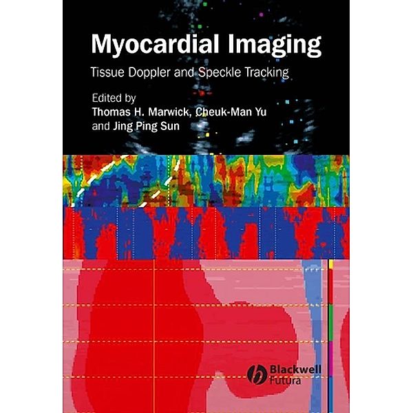 Myocardial Imaging