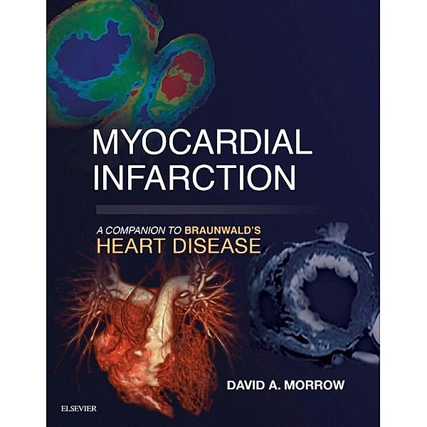 Myocardial Infarction: A Companion to Braunwald's Heart Disease E-Book / Companion to Braunwald's Heart Disease, David A Morrow