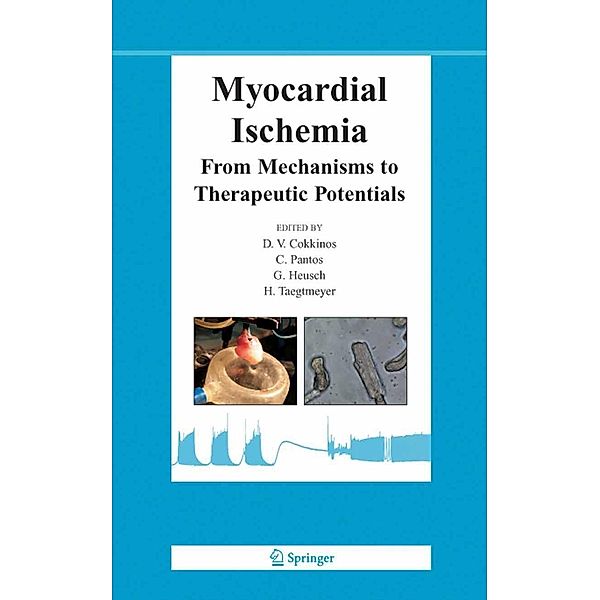 Myocardial Ischemia / Basic Science for the Cardiologist Bd.21