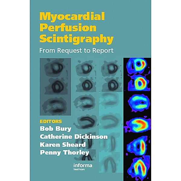 Myocardial Perfusion Scintigraphy, Bob Bury, Catherine Dickinson, Karen Sheard, Penny Thorley