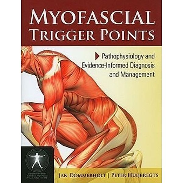 Myofacial Trigger Points: Pathophysiology and Evidence-Informed Diagnosis and Management, Jan Dommerholt, Peter Huijbregts