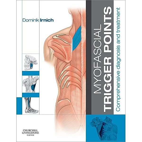 Myofascial Trigger Points, Dominik Irnich