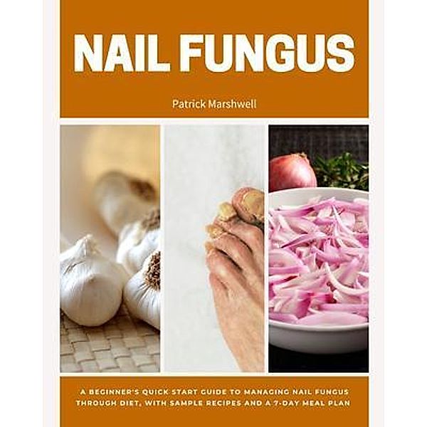 Nail Fungus, Patrick Marshwell