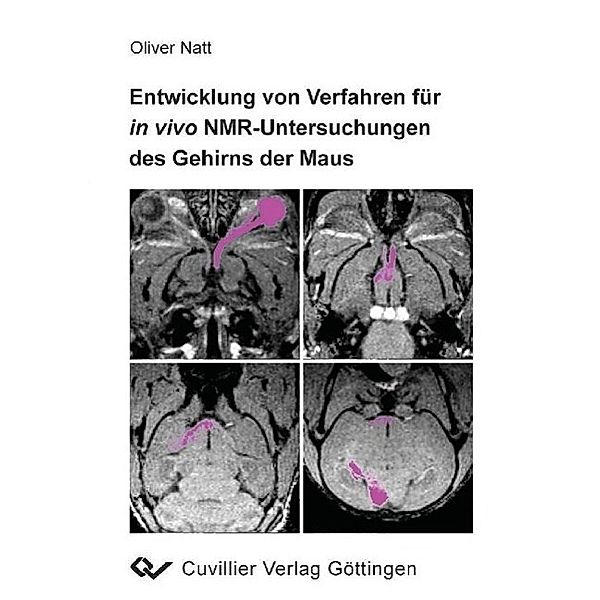 Natt, O: Entwicklung von Verfahren für in vivo NMR-Untersuch, Oliver Natt